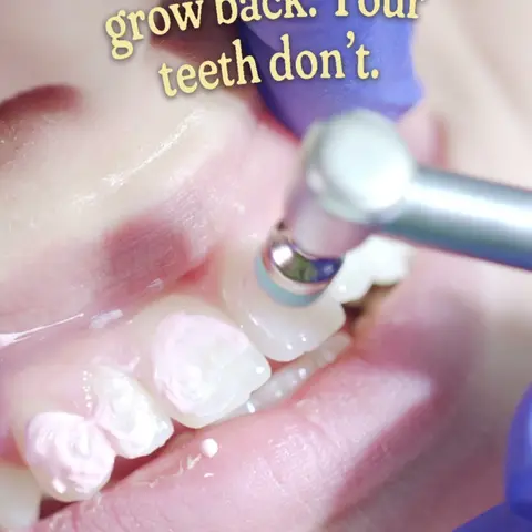 Your nails grow back. Your hair grows back. Your adult teeth are the only set you get. Tartar hardens on your teeth and brushing at home can