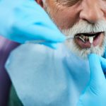 close up of dentist implanting dental veneers on senior patient