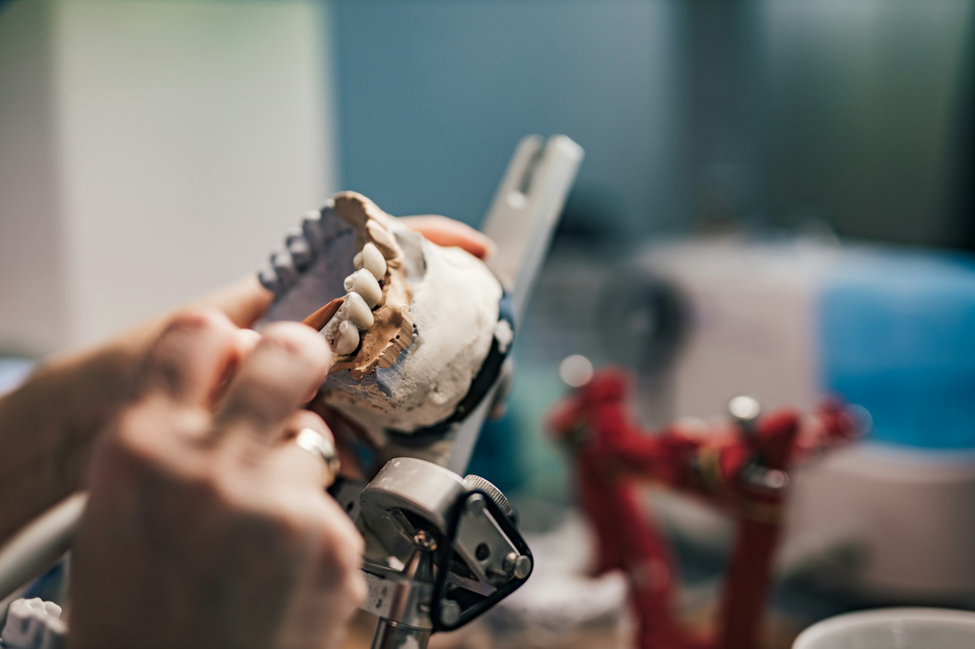 Dentist working on the denture, Prosthetic work.