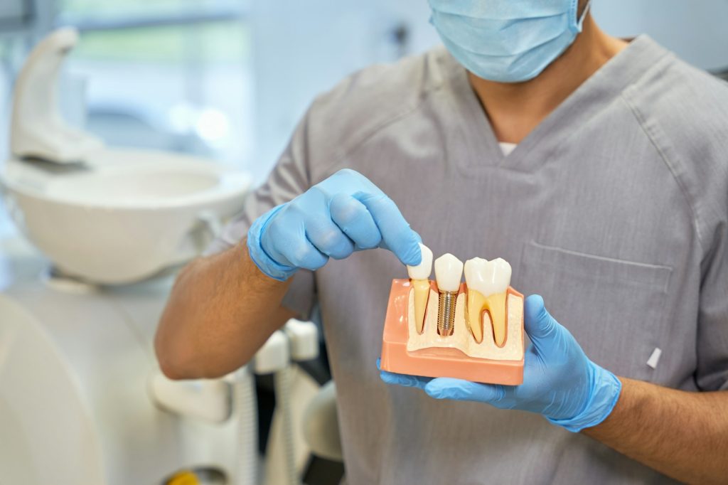 Skillful dental technician showing anatomy of dental implant