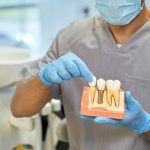 skillful dental technician showing anatomy of dental implant