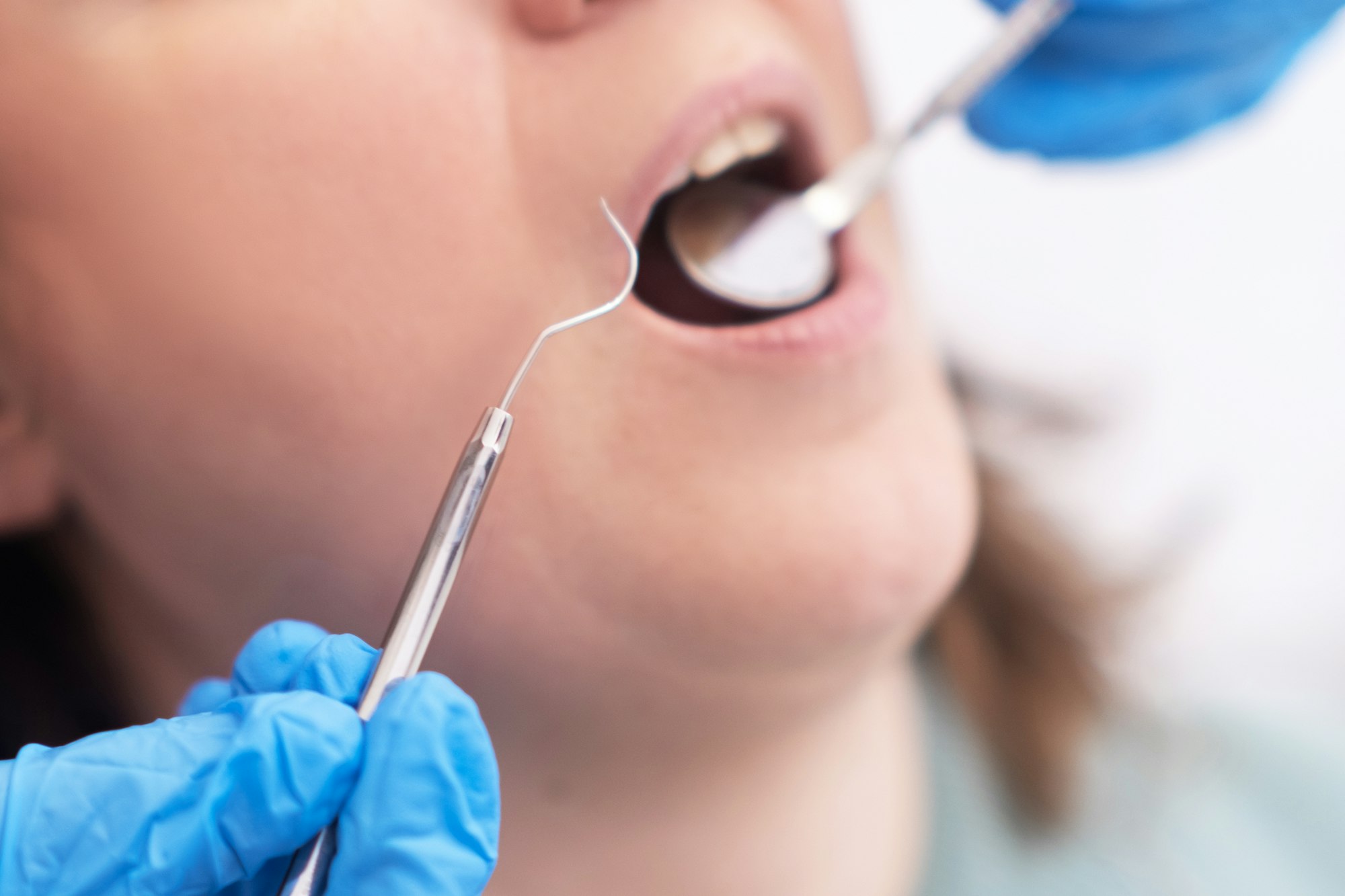 dental treatment to maintain her oral health by dental specialist dental facility. close up