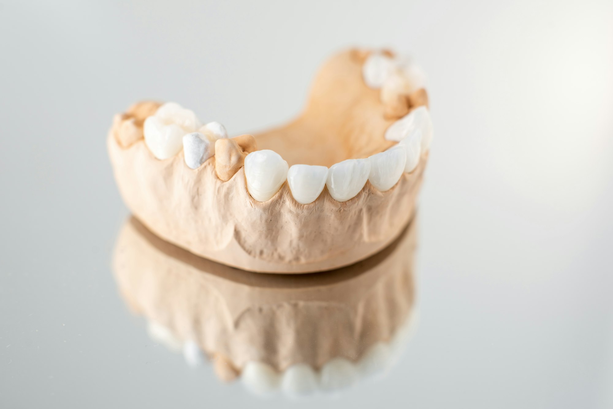 Model of artificial jaw with veneers