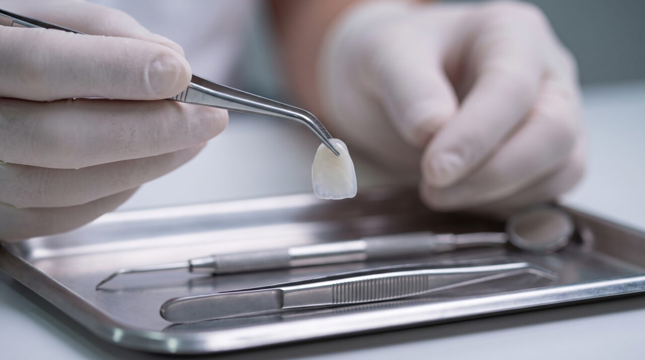 Dentist holding a thin translucent porcelain veneer shell with tweezers in a Tamarac dental office