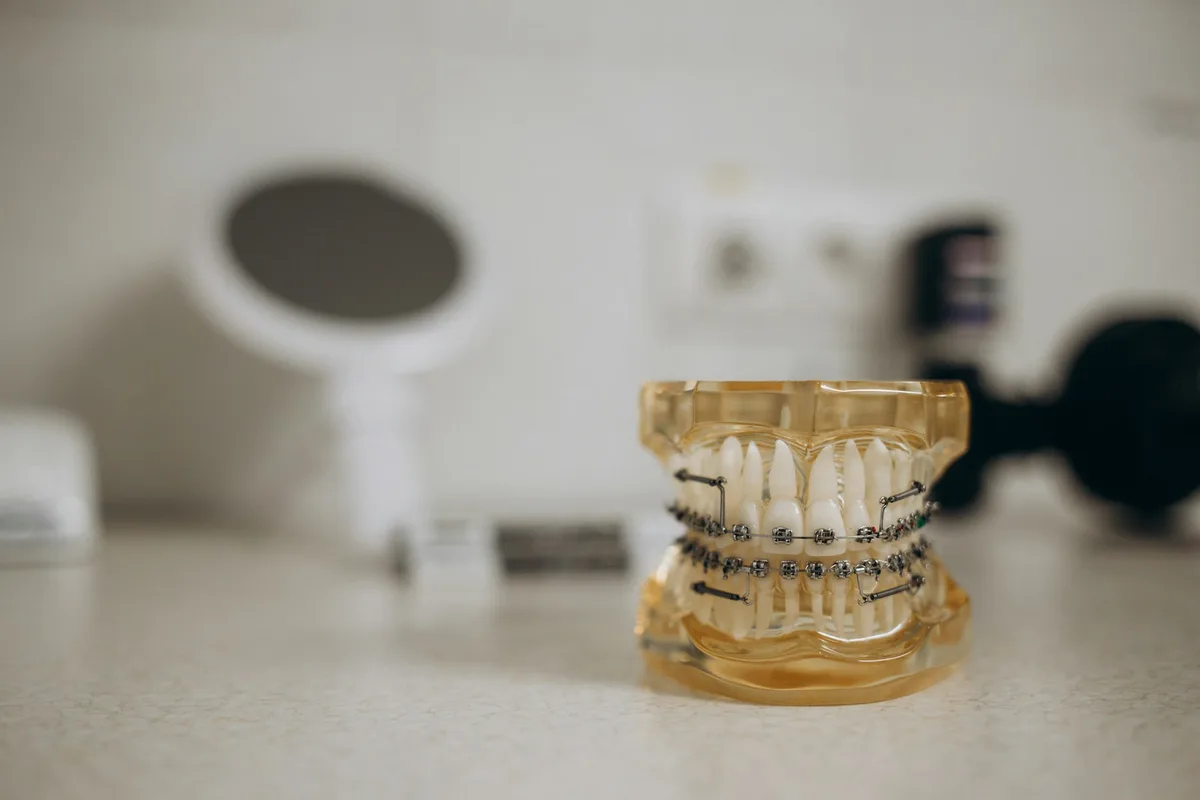 Modelo de arcada dental con brackets metálicos y arco de ortodoncia sobre una mesa de clínica