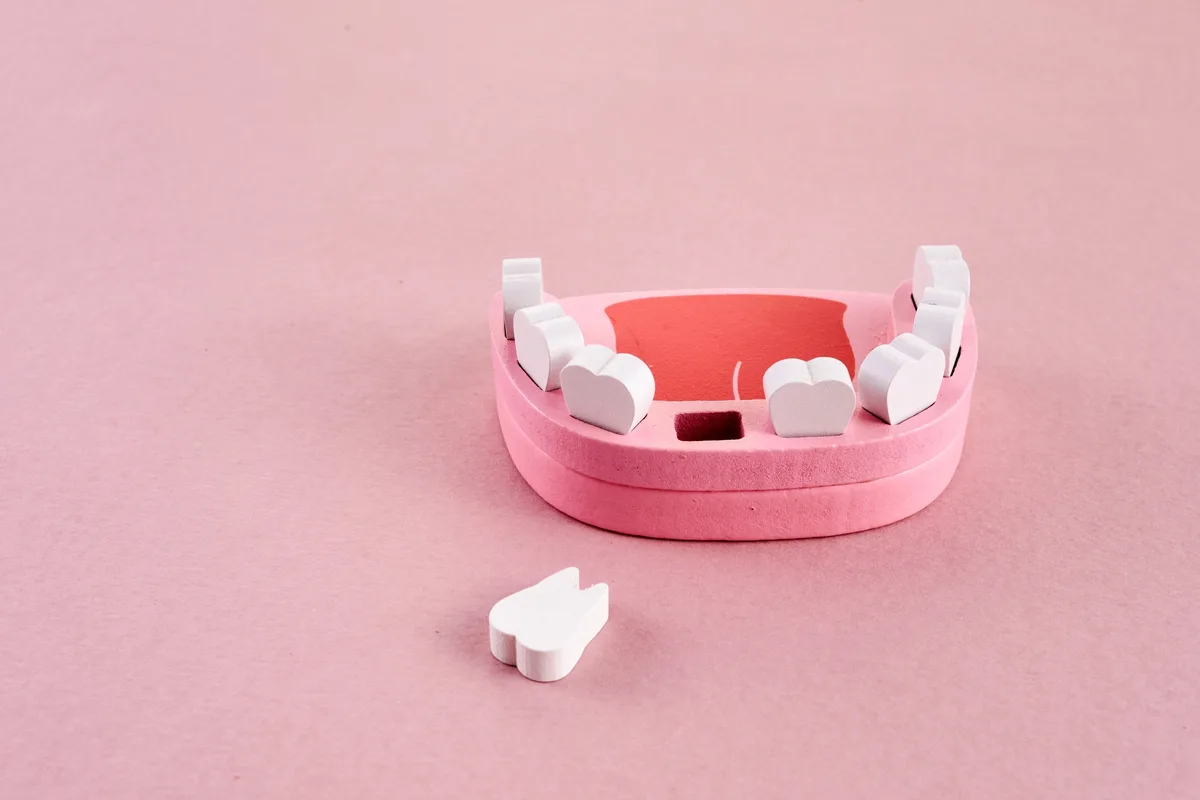 A pink dental model of a lower jaw with a gap where one tooth is missing, the removed tooth lying in front of it