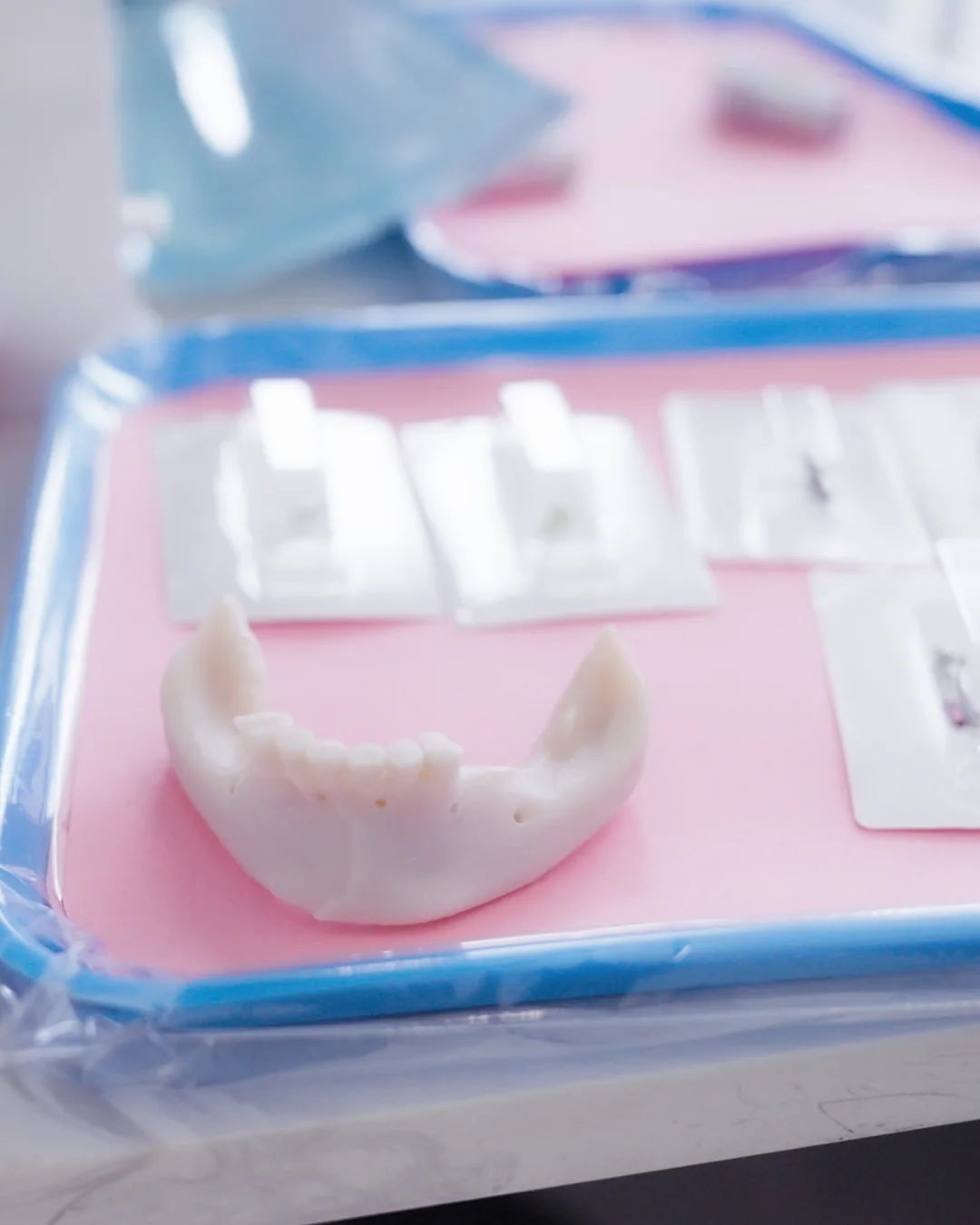 All-on-4 Dental Implants in Tamarac, FL 2 Full-arch model and sealed implant kits on the surgical tray before an All-on-4 procedure at Metropolitan Smile Design, Tamarac FL