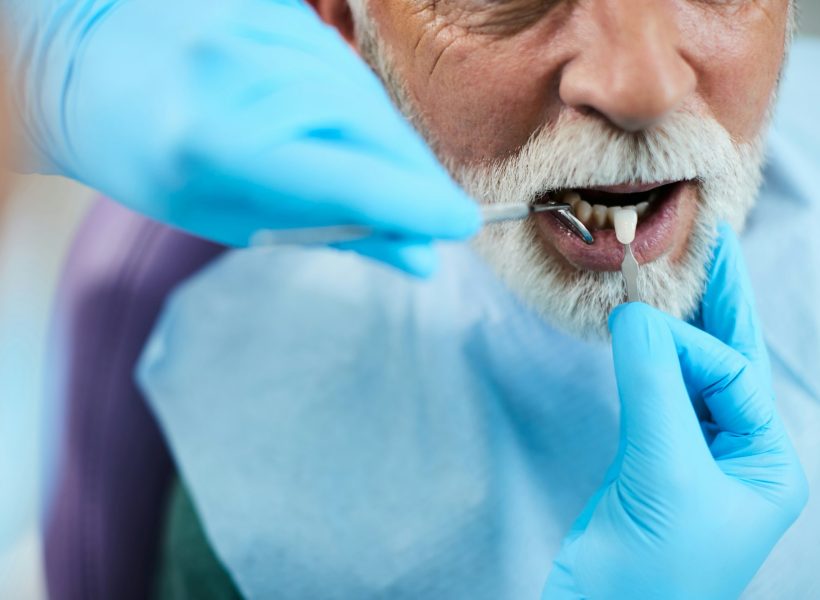 Close up of dentist implanting dental veneers on senior patient.